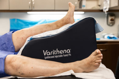 Varicose Veins? Meet Varithena: Microfoam Sclerotherapy Near You