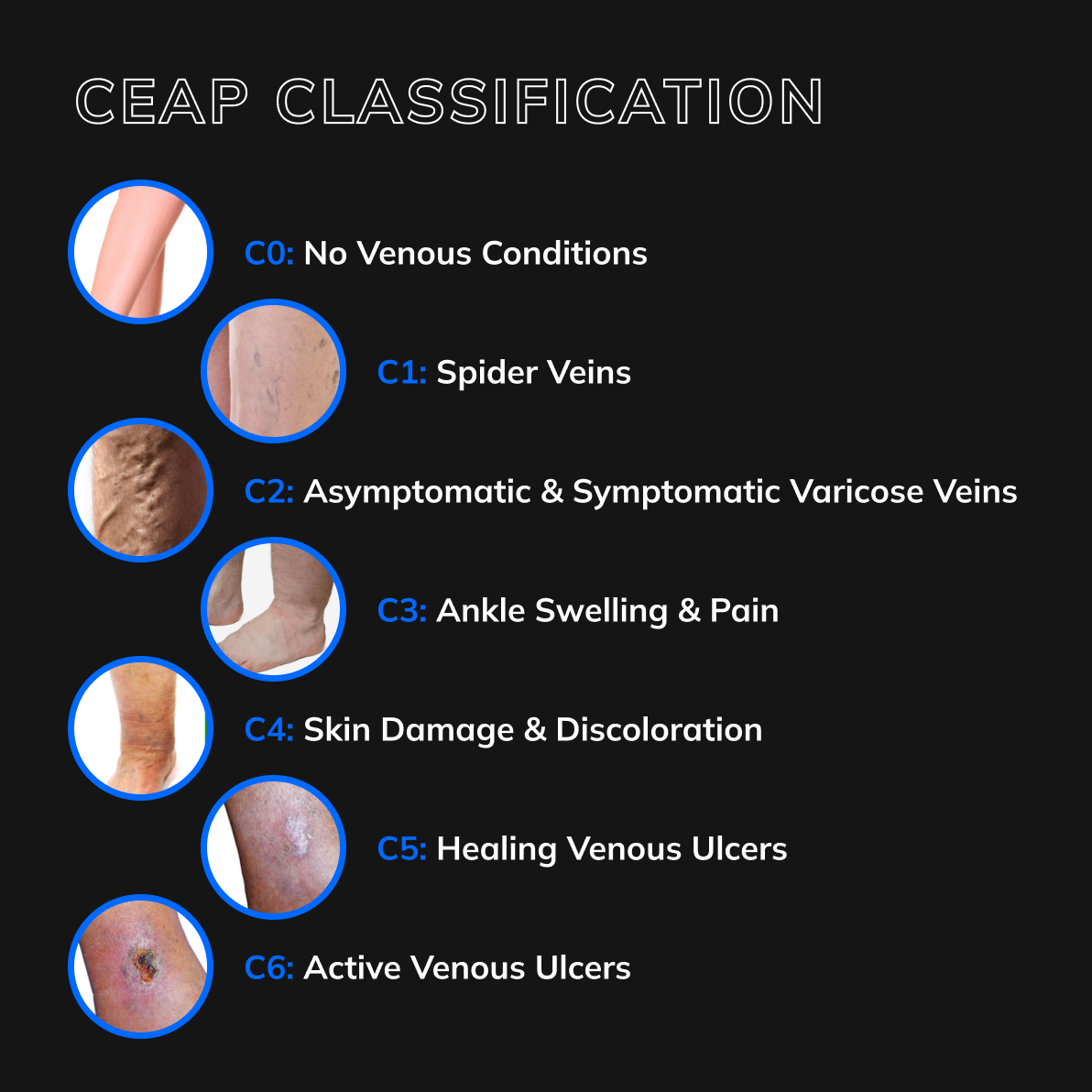 ceap classification in Rogers