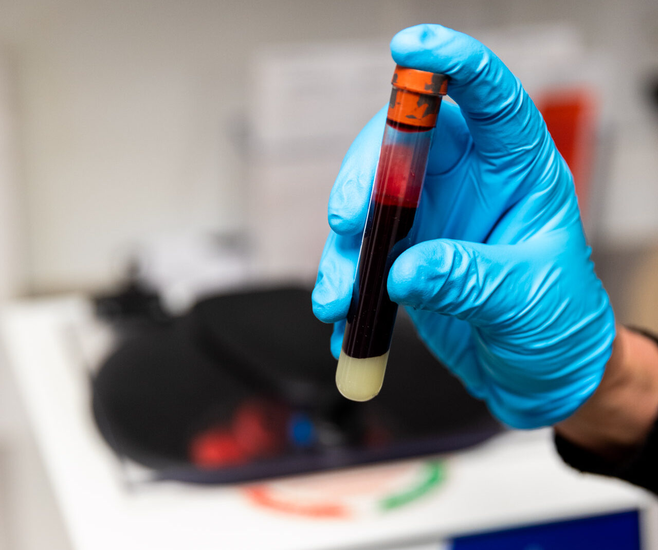 A provider carries a vial of blood and plasma before administering PRP injections for knee pain in Rogers, AR.
