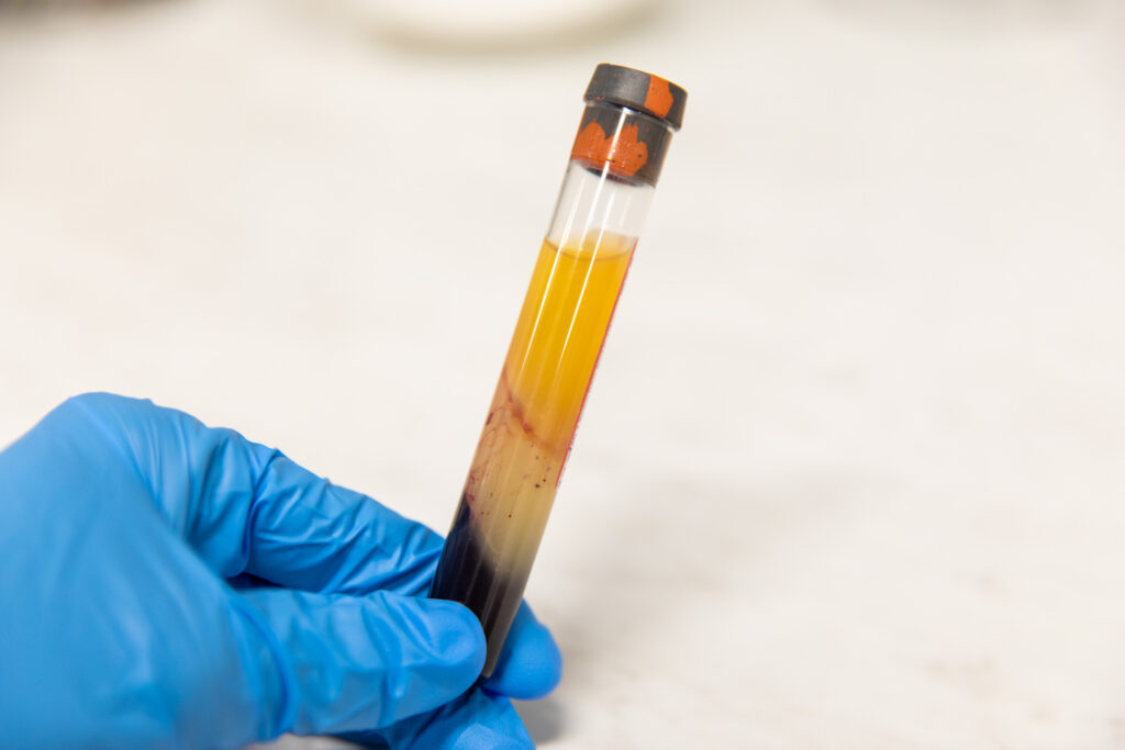 Enhanced PRP Knee Injections in Rogers, Arkansas.